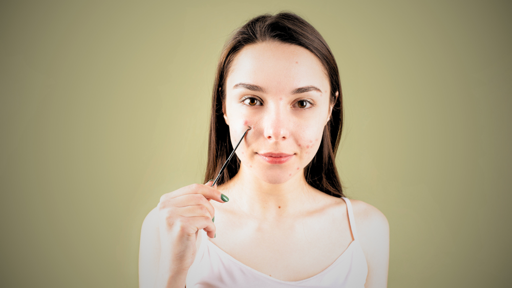 Estudo global liga irregularidade menstrual a mais acne, melasma e rosácea, diz British Journal of Dermatology