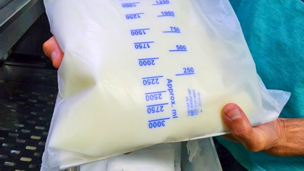 Hospital Regional de MS economiza R$ 1,6 milhão com inovação na Nutrição Parenteral Total